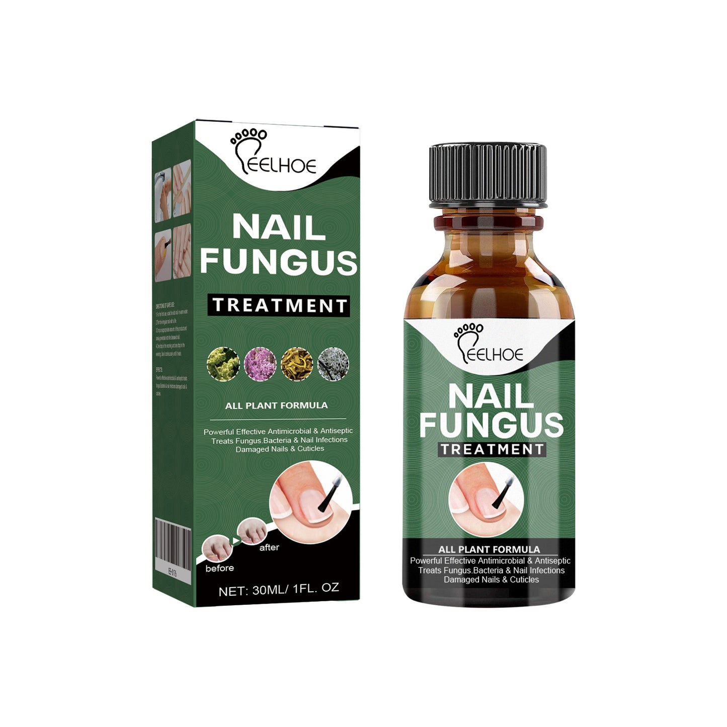 EELHOE Nail Treatment 30ml Nails With Thick Nails And Soft Nails That Gently Cleanse And Moisturize The Nails