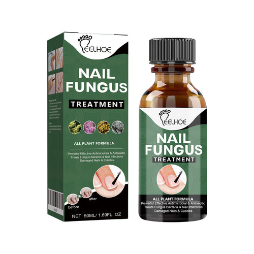 EELHOE Nail Treatment 30ml Nails With Thick Nails And Soft Nails That Gently Cleanse And Moisturize The Nails