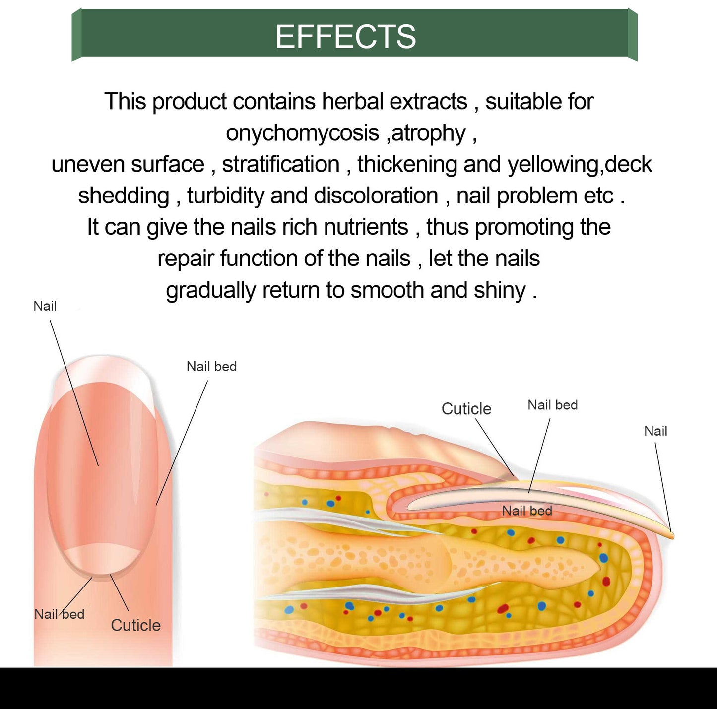 EELHOE Nail Treatment 30ml Nails With Thick Nails And Soft Nails That Gently Cleanse And Moisturize The Nails